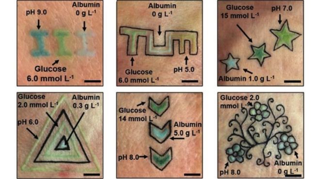 Немецкие ученые придумали татуировку для диабетиков