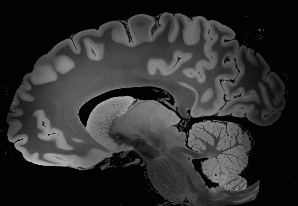 Медики получили самое детальное изображение мозга человека