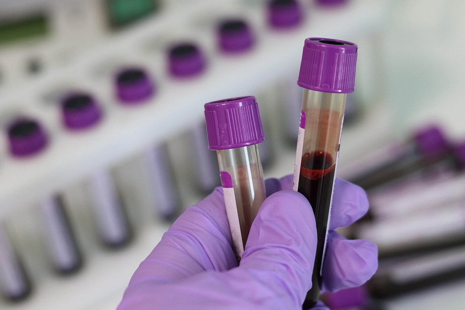 Эксперты рассказали об особенностях людей со второй группой крови