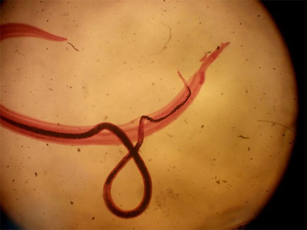 Ученые придумали способ защиты от ВИЧ с помощью личинок червей-паразитов