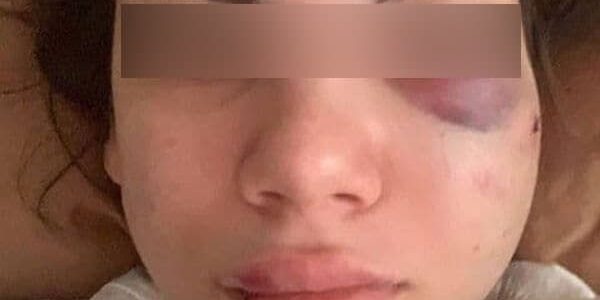 В Краснодаре парень избил девушку в трамвае из-за нецензурных слов