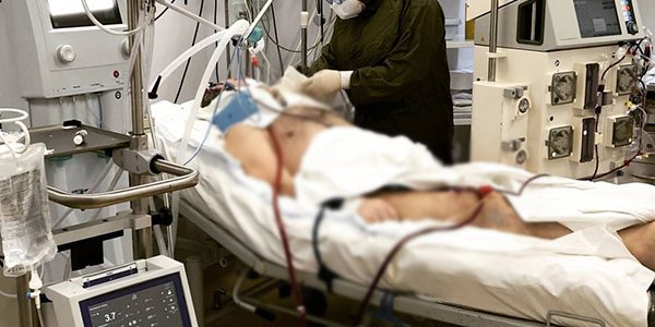 В Краснодаре спасли больного коронавирусом мужчину с 95% повреждением легких