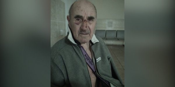 В Краснодаре девочка на электросамокате сбила 84-летнего мужчину в дендрарии