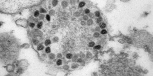 Роспотребнадзор опубликовал фотографии клеток, зараженных «омикроном»