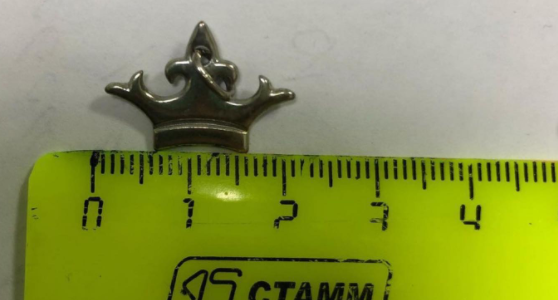 В горбольнице Новороссийска врачи достали корону из пищевода маленькой девочки
