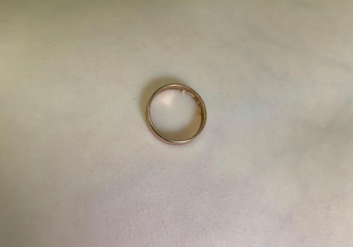 В Туапсе хирурги достали кольцо из желудка двухлетней девочки