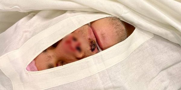 Краснодарские врачи восстановили парню откушенный в драке нос