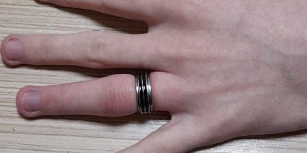 В Новороссийске спасатели помогли парню снять с пальца два кольца