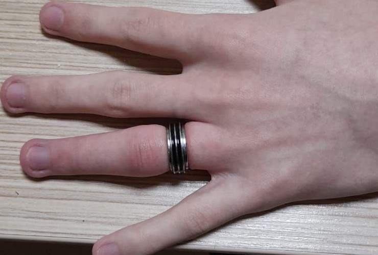 В Новороссийске спасатели помогли парню снять с пальца два кольца