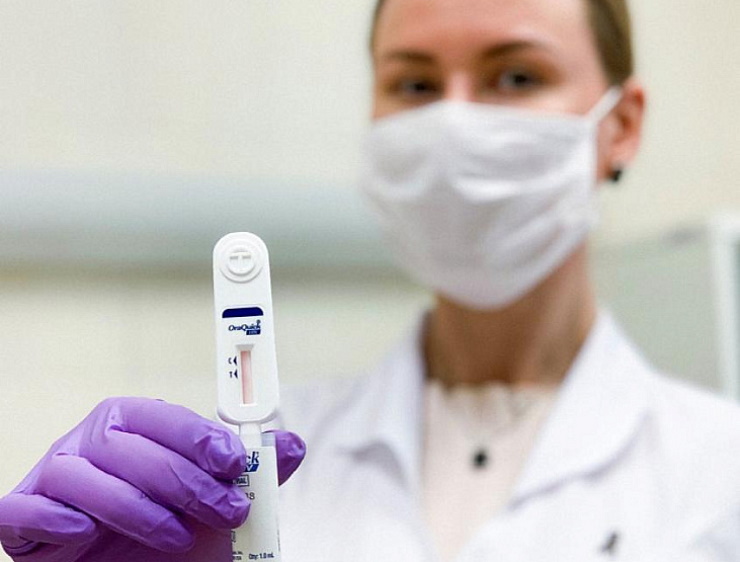 Краснодарцы 14 мая смогут пройти экспресс-тестирование на ВИЧ
