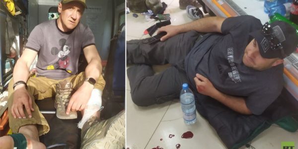 Операторы RT попали под обстрел ВСУ на Донбассе и получили ранения