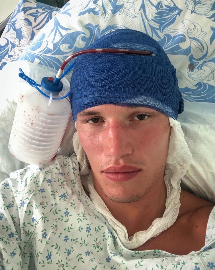 В Геленджике чемпион мира по боевым искусствам получил тяжелую травму во время отпуска
