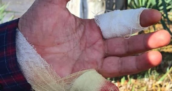 В Анапе двое парней ночью отрезали палец охраннику, мешавшему им искать закладку