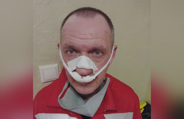 В Краснодаре неадекватный мужчина сломал нос врачу скорой помощи, приехавшей к нему на вызов