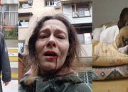 В Сочи пенсионер ударил женщину палкой по лицу из-за выгула собаки