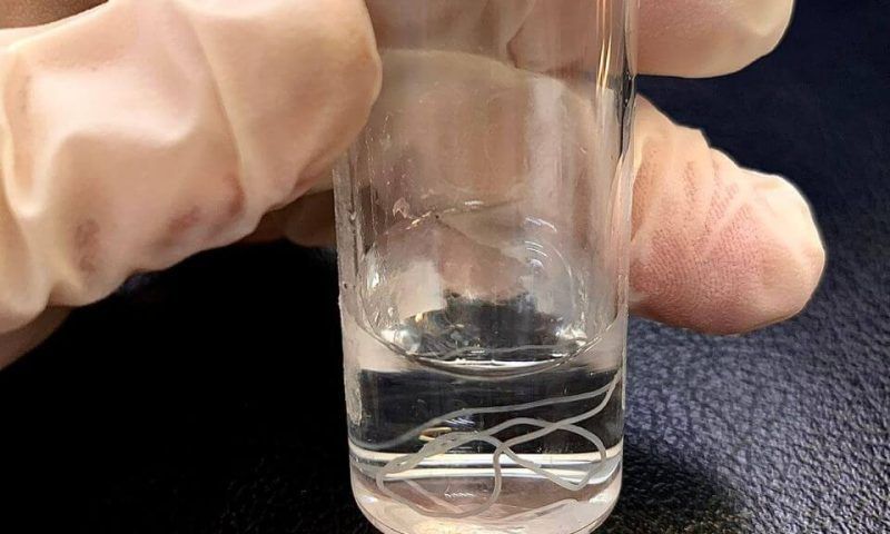 Укусил комар: в Краснодаре врачи извлекли из тела женщины длинного червя-паразита