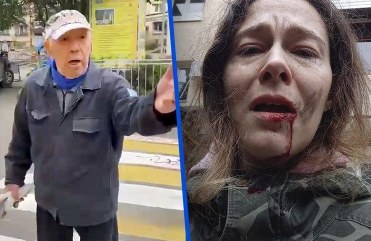 В Сочи пенсионер ударил женщину из-за выгула собаки: в чем причина конфликта?