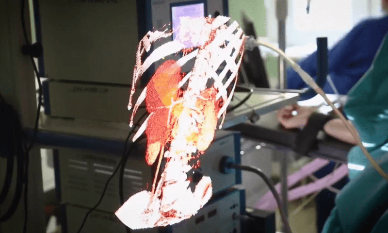 Первую операцию с использованием голографии провели хирурги в Краснодаре