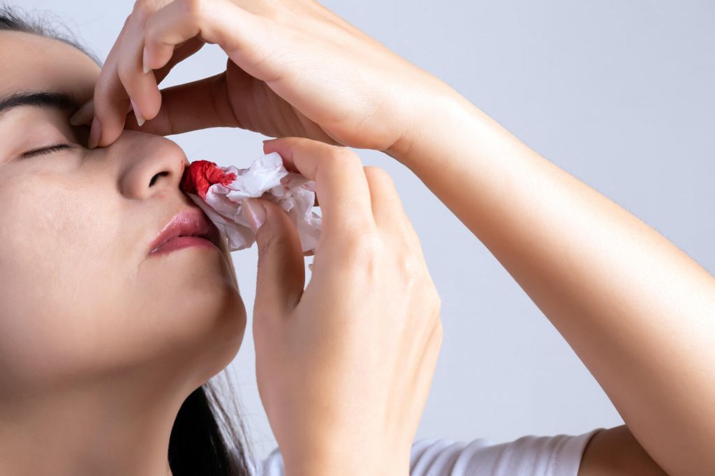 Как остановить носовое кровотечение: что можно и нельзя делать
