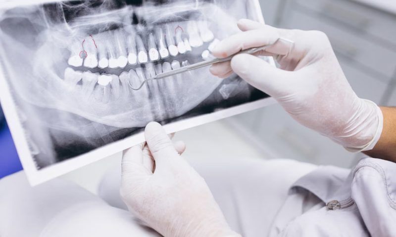 Стоматолог объяснила связь между проблемами с зубами и болезнями внутренних органов