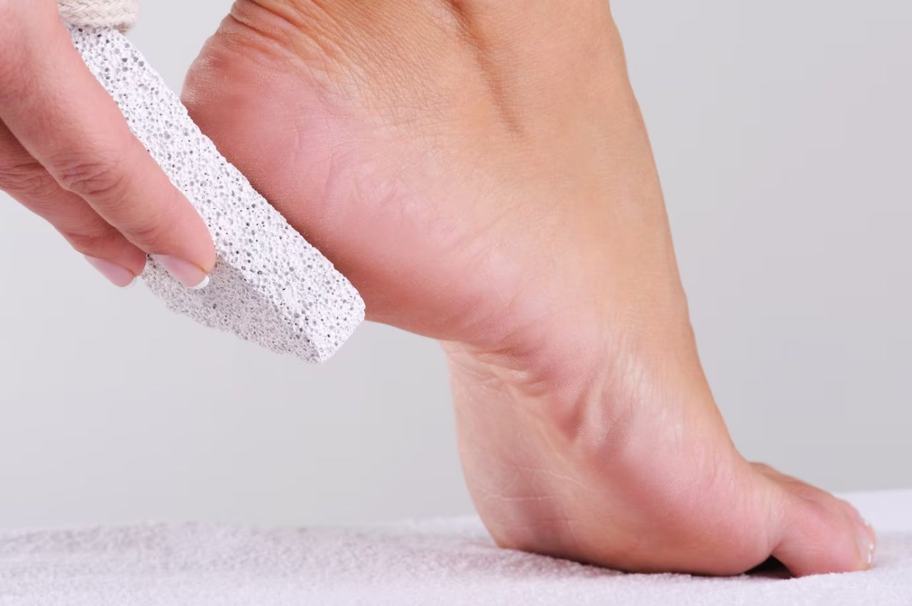 Мягкие пяточки: ухаживаем за сухой кожей ног