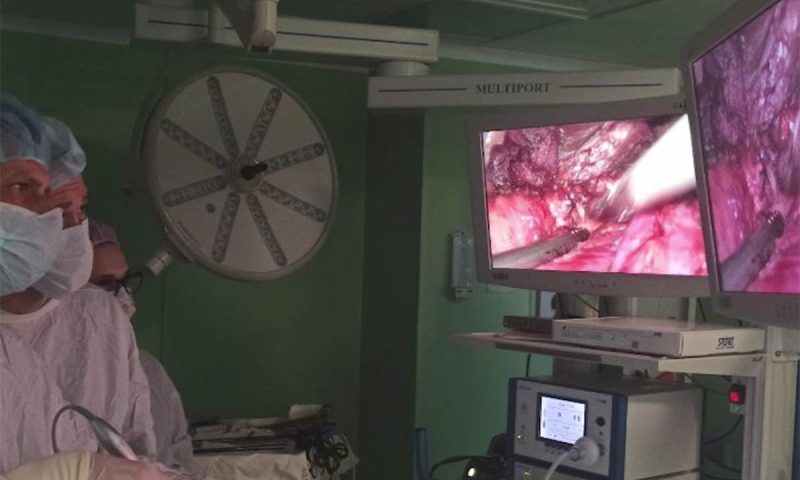 Хирурги в Краснодаре провели сложную операцию пациентке по удалению опухоли