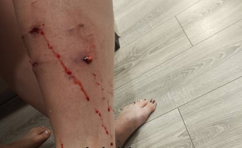 Бездомная собака напала на женщину и прокусила ей ногу в Краснодаре