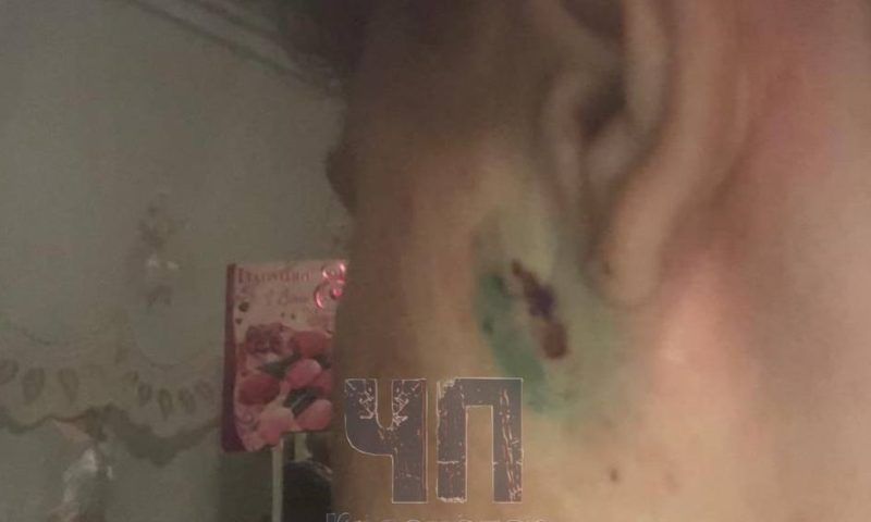 Мальчик ударил ножом в лицо старшеклассника в школе на Кубани