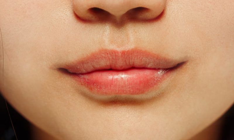 Почему трескаются губы и как их лечить