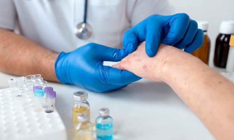 Цыпки на руках: о симптомах и профилактике холодового дерматита | OmniusClinic | Дзен
