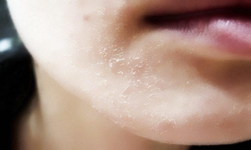 Пять способов от шелушения кожи на лице - 9 ноября, 2023 Статьи «Кубань 24»