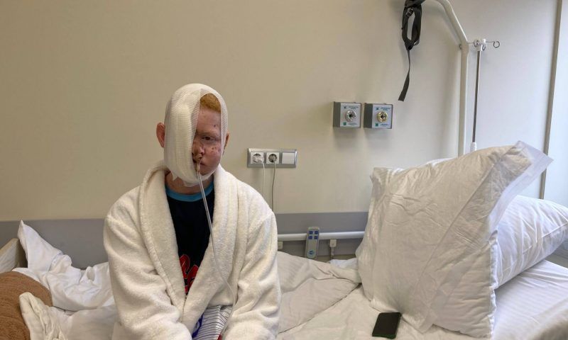 Разрушенное меланомой лицо альбиноса из Сенегала восстановили в Краснодаре