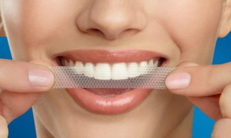 Отбеливающие полоски для зубов: как выбрать и пользоваться
