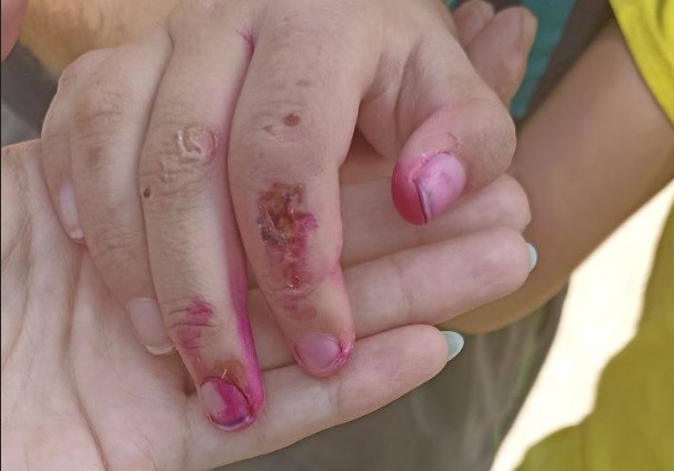 На Кубани 13-летнюю девочку истязали в специальном лечебном учреждении