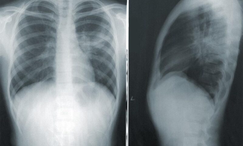 В Сочи призывник пытался «откосить» от армии с помощью чужих рентгенснимков