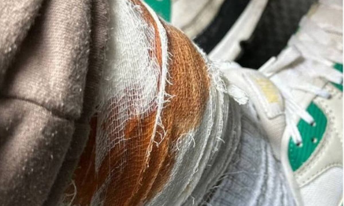 Бродячие собаки покусали подростка на улице в Юбилейном микрорайоне Краснодара