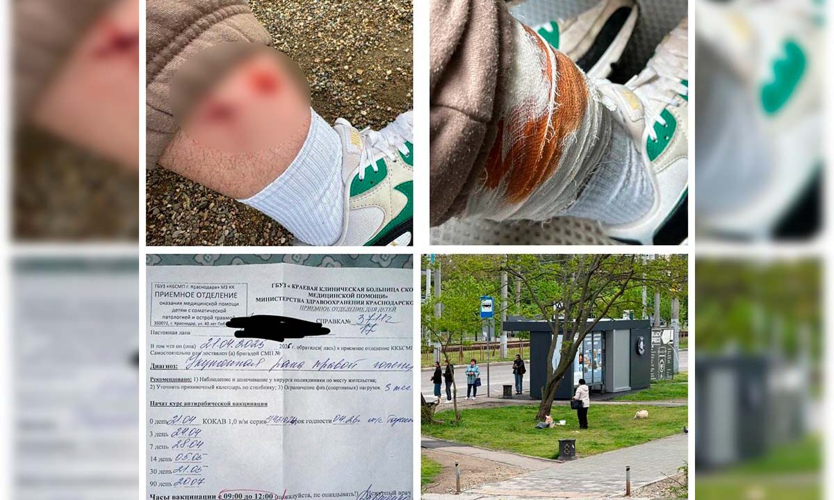 СК возбудил дело о нападении бездомной собаки на подростка в Краснодаре