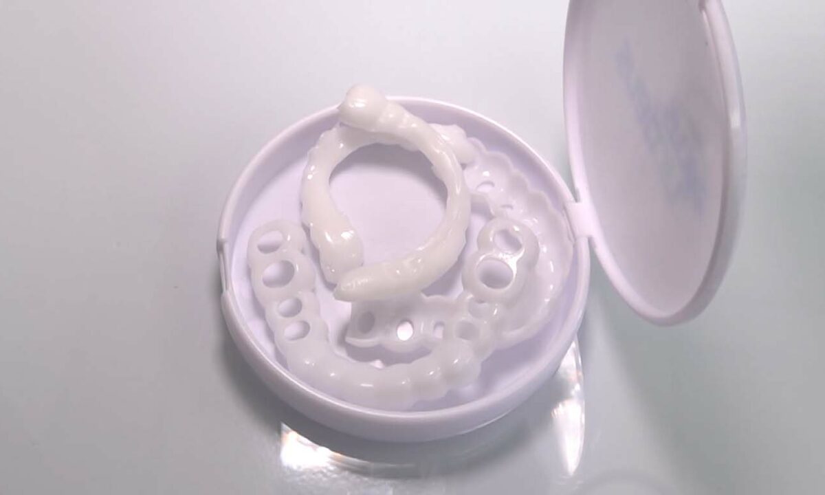 Дешевые домашние виниры с маркетплейсов вызывают опасения стоматологов Кубани