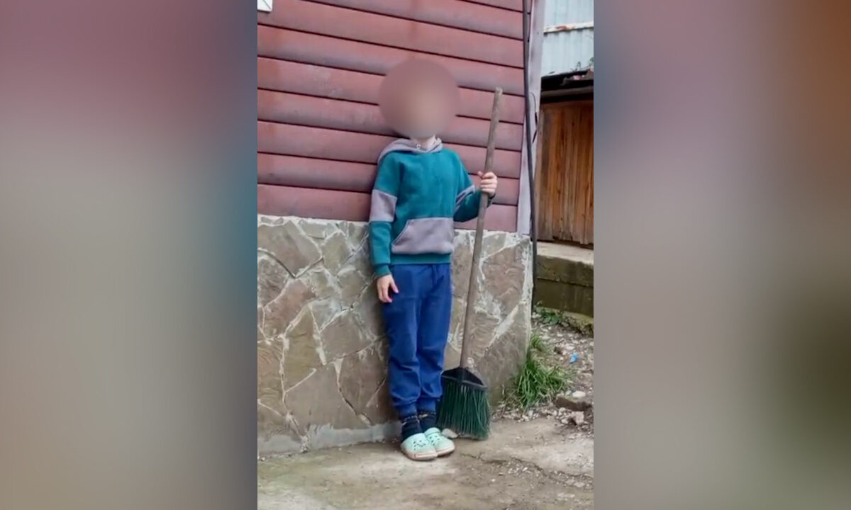 Мальчик из Сочи, которому хаски разорвали лицо, начнет дышать сам — без трубки