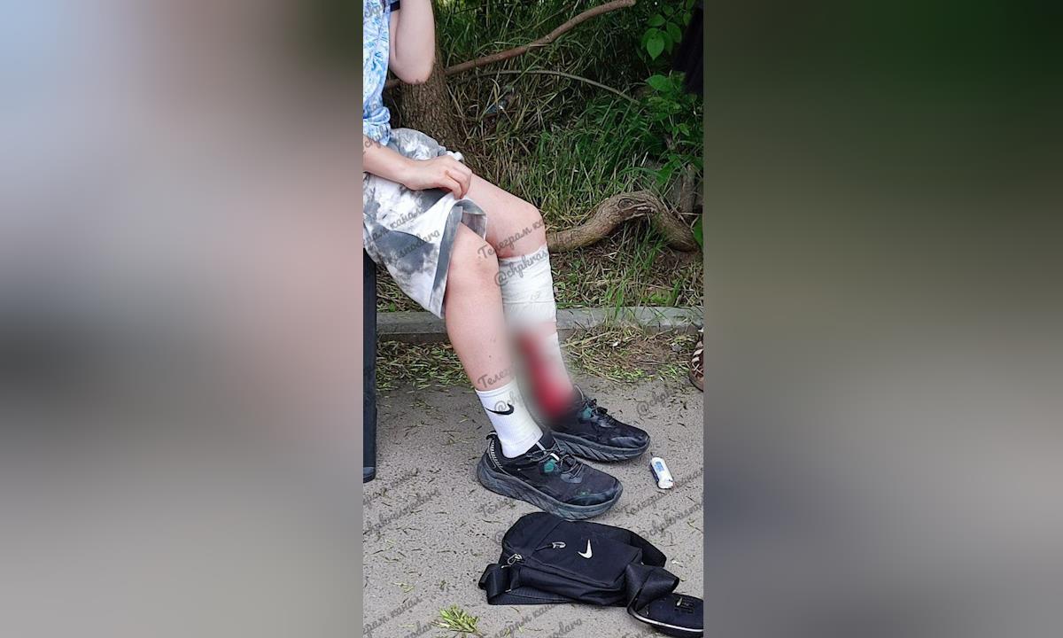 Бездомная собака покусала 11-летнего мальчика на Карасунах в Краснодаре