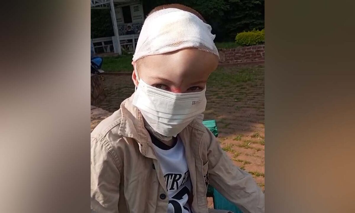 Дату пластики носа покусанному хаски мальчику из Сочи назначит консилиум врачей