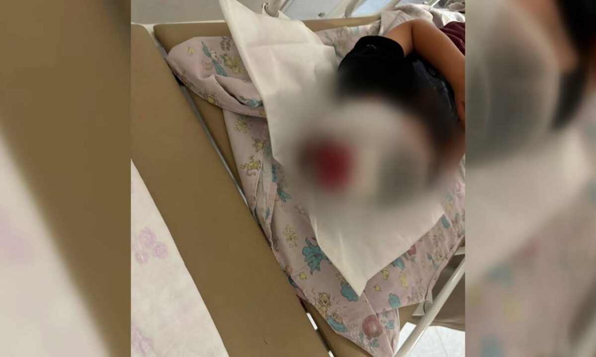 Мать сбитого самокатом 4-летнего мальчика в Краснодаре рассказала о ДТП
