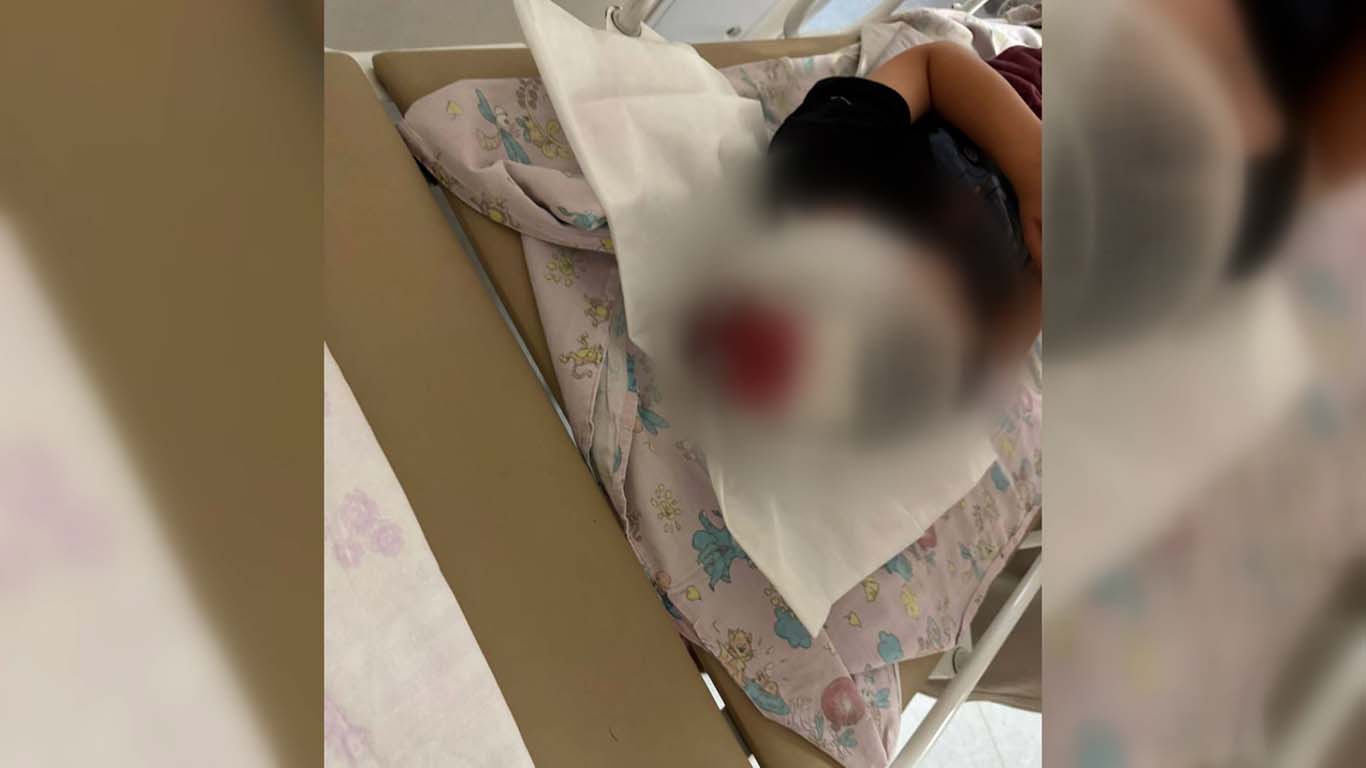 Мать сбитого самокатом 4-летнего мальчика в Краснодаре рассказала о ДТП