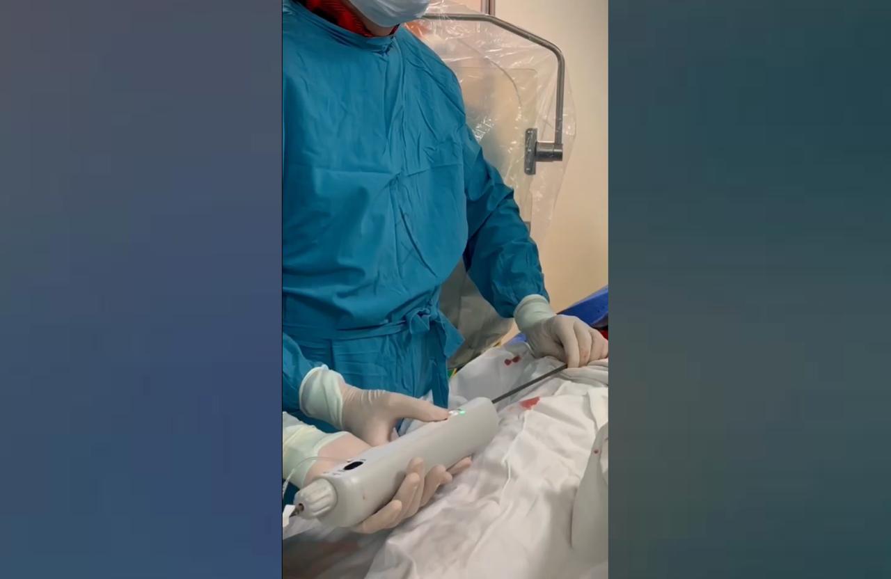Хирурги Кубани впервые провели повторную установку сердечного клапана в протез