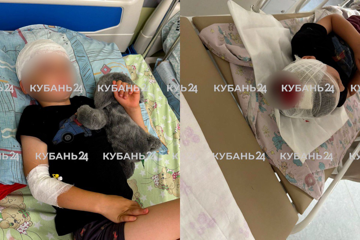 В Краснодаре 4-летний мальчик получил травму головы после наезда электросамоката