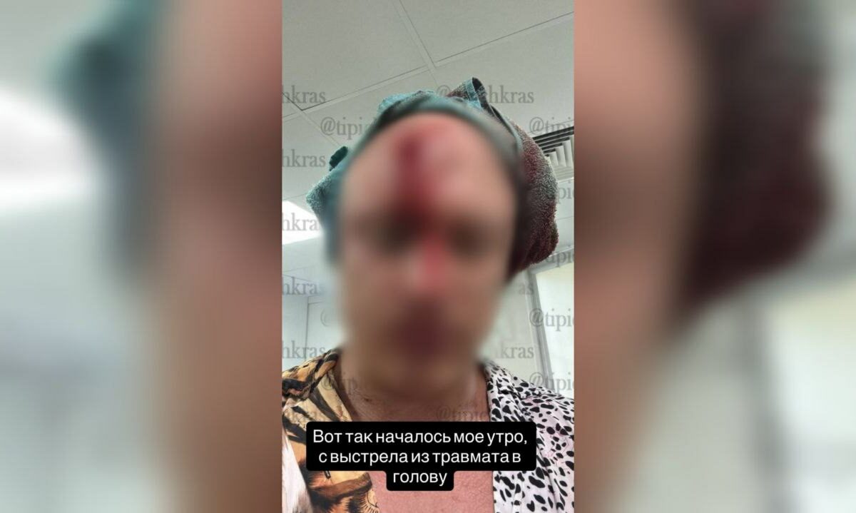 Мужчине выстрелили из травмата в лоб во время погони в центре Краснодара
