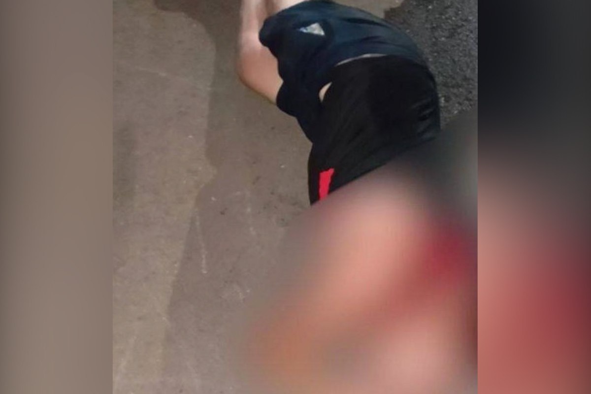 Мужчина попал в больницу после конфликта с подростком в Брюховецком районе