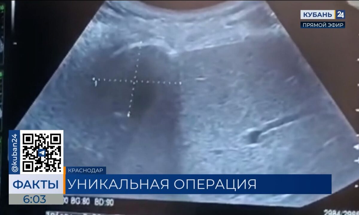 В Краснодаре врачи провели уникальную операцию — криоаблацию опухоли легкого