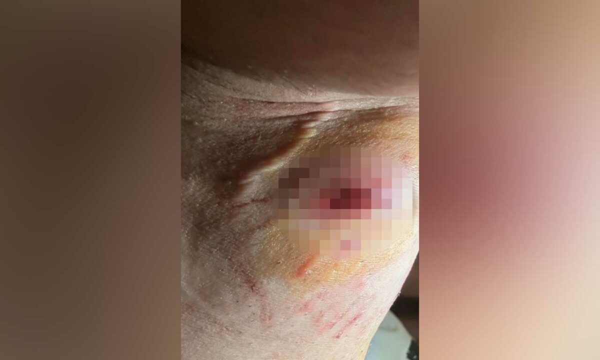 Жители Крымска пожаловались на агрессивных собак постоянно пьяного соседа