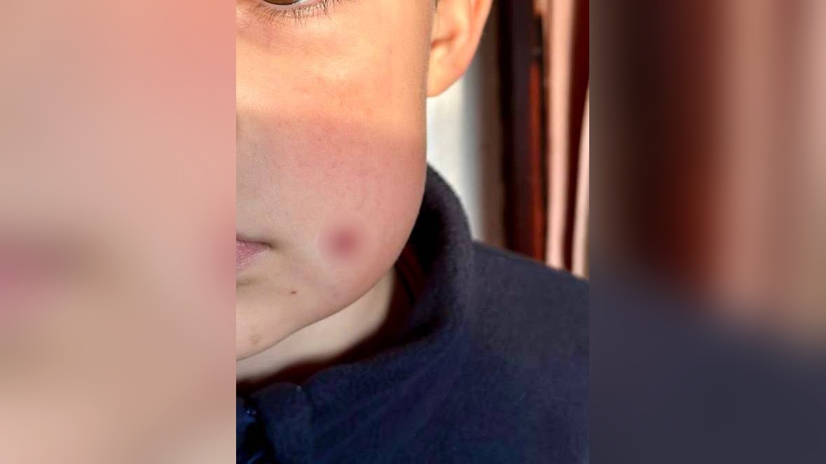 В Туапсе мужчина выстрелил из пневматического ружья в лицо 9-летнему ребенку